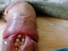 Maggots In Slit Urethra Playing