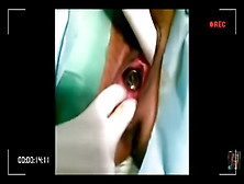 Performing Vagina Operation.