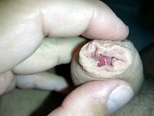 My Uncut Phimose Cock