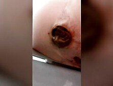 Sticky Shit Gaping Hole