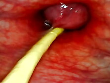 EXTREME ANAL POINT OF VIEW. ONLINE CAM INSIDE HER BUTT-HOLE AS I POUND HER WITH MY MONSTROUS MEAT AND SPERM DEEP INSIDE