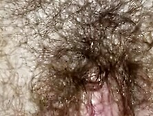 Hairy Pussy Fisting