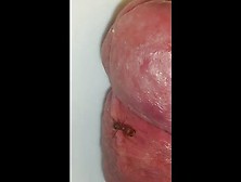 Harvester or fire ant biting and sting my cock