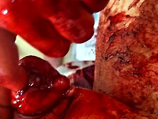 Exposed Testicle Destruction - Bloody