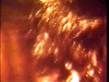 Disgusting Vicious Sucker