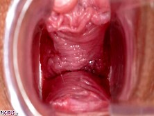 I want to show you something naughty - Speculum in Motion