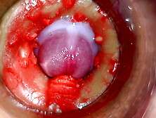 Online cam Inside Deep Vagina Captures Gigantic Ejaculation of Jizz 4k