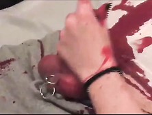 Bloodplay with needles.