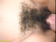 Hairy Teenie Rear-End B.  Destroyed By A Enormous Penis