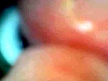 Endoscope camera captures pont of time of boy cumshot