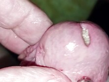 Maggots In Juicy Hole