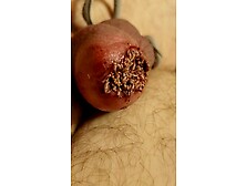 Maggots Feeding On A Tied Off Cock Slit