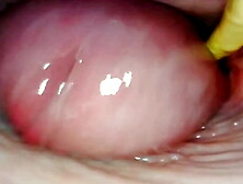 AMAZING INTERNAL SELF PERSPECTIVE.  WEBCAM INSIDE HER VAGINA WHILE I FILL HER WITH SPERM