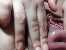 Cervix Show,  Rub And Try To Put A Finger In