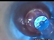 test tube cock endoscope POV urethral insertion ba