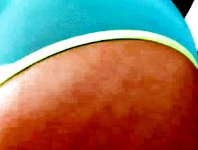 Emilys Throat Singed