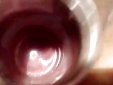 Big Pee, Fuck Pussy And Show Inside, Cervix Show