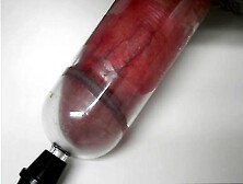 Slideshow Filling 18 Cm Penis Pump