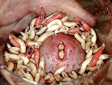 Maggot in urethra