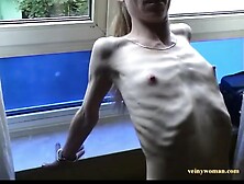 Anorexic Cindy 5