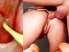 Amazing Anal Camera In Her Ass Deep Anal Fuck And Internal Creampie - Sergy Loven