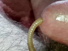 Worm Video 257