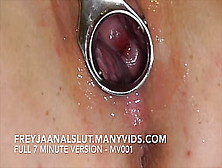 Amatuer Freyjaanalslut : Removing Her Iud - Pulling It Out Of Freyja's Cervix,  Making Her Fertile Again - Full Version On Manyvi