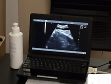 Tiny Twink Barebacked On Ultra Sound