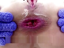 Compilation Fuck Anal With Insane Pornstar