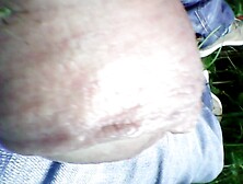 mosquito bites penis