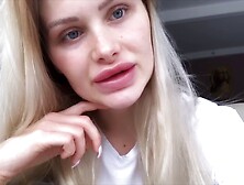 Too much surgery fake lips