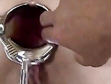 Elmer mega anal gape