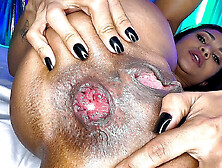 flexi slender mother i'd like to fuck prolapse her asshole for coarse banging