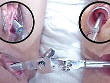 Mature Lesbians Cervix Insertion and Pee hole Fucking