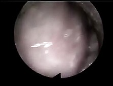 Video Internal Vagina