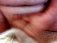 Vorhaut dehnen mit Spekulum