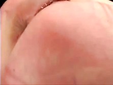 Slave punished Cunt stapled shut - Ouch!