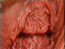 Monster Vagina Extreme Piercing Fisting