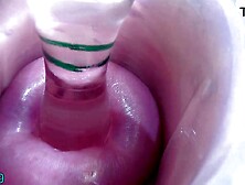 Lesbos cervix play penetration, fingering and void urine directly into the bladder of the other woman by peehole