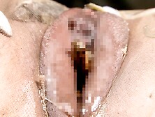 Genten 038 (GETN038)