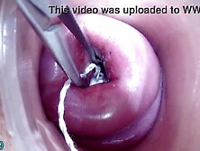 Lesbian babes pissing into the cervix of the other one directly since her pee gap