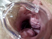 Mature lesbians play in a gynecologist,  open the vagina with a medical dilator,  examine the cervix.