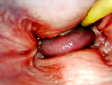 AMAZING INTERNAL POV. CAMERA INSIDE HER PUSSY WHILE I FILL HER WITH CUM