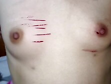 Beautiful Small Breast Being Cut