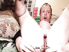 Perverted Guy Is Stretching His Butthole With Speculum On Webcam Show