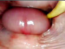 ASTONISHING INWARD POV.  CAMERA INSIDE HER SNATCH WHILST I FILL HER WITH CUM