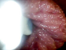 Endoscope Camera Shows the Most Sensitive Parts of the Penis Educational Video