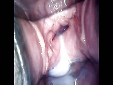 Speculum Observation During Continuous Vaginal Creampie