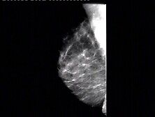 Blonde Milf's Mammogram