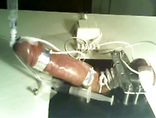 Electro Stim ejaculation into an inserted tube